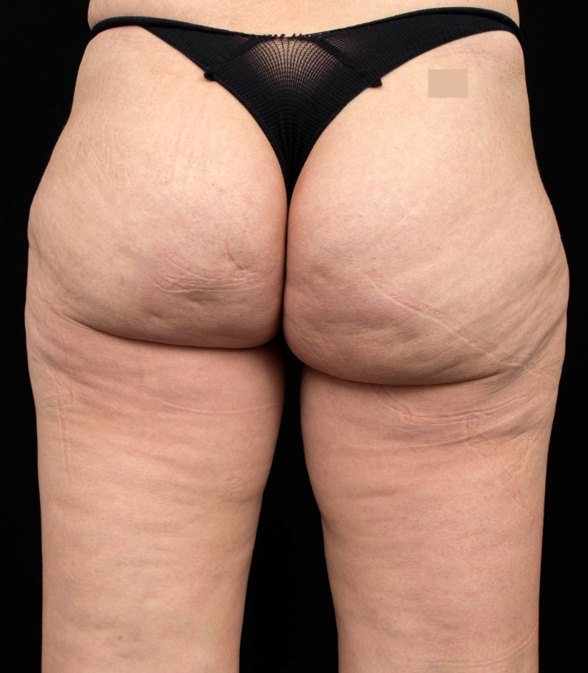 after image
