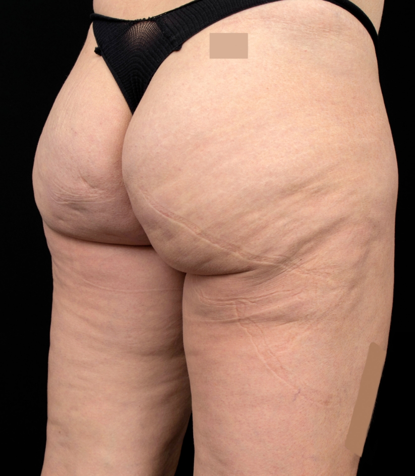 after image