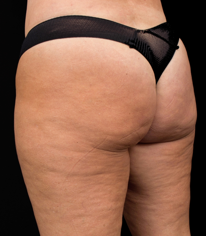 after image