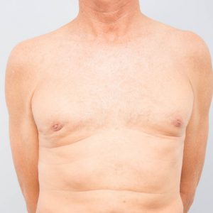 after image