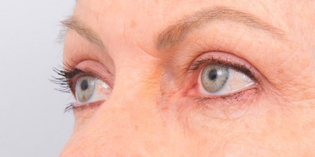 after image