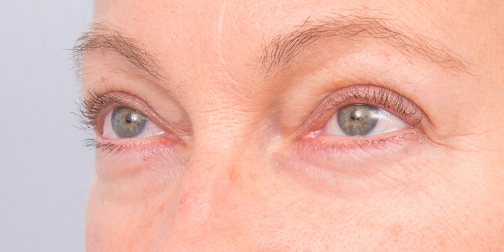 after image