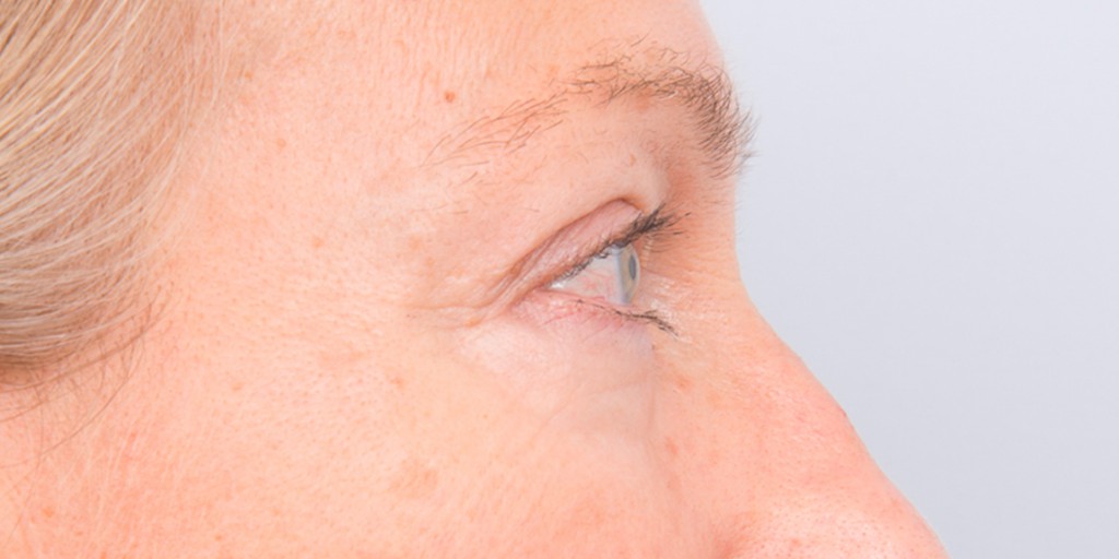 after image