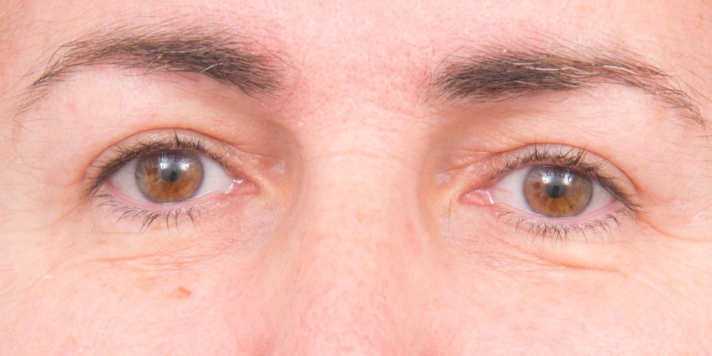 after image
