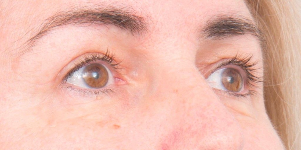 after image