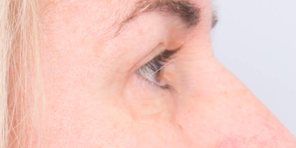 after image