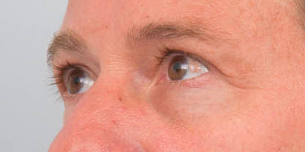 after image