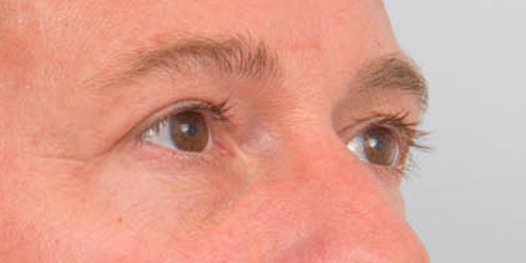 after image