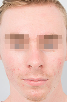 before image