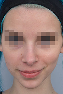 after image