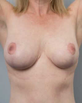 after image
